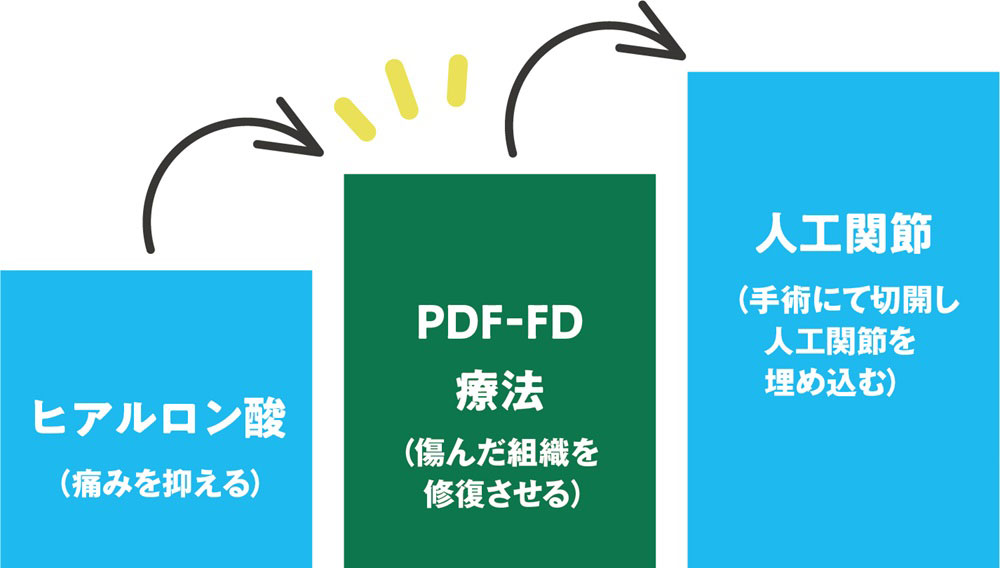 PDF-FD療法